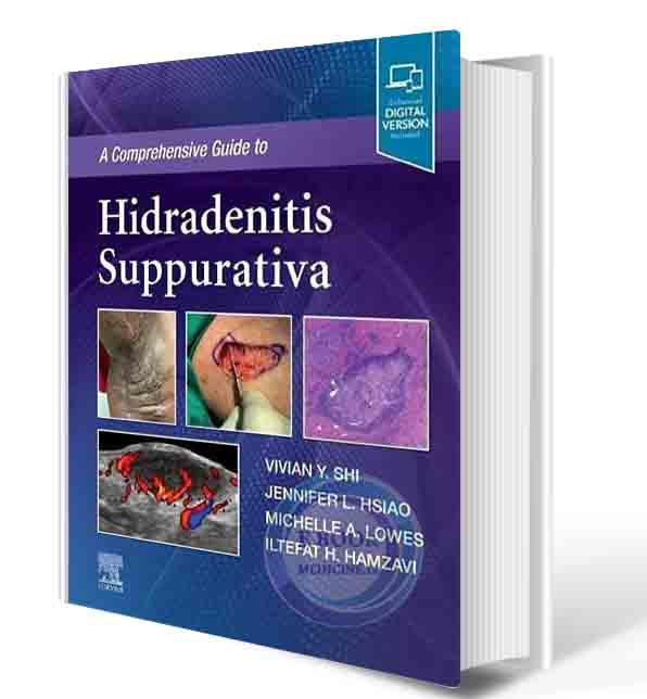 دانلود کتاب A Comprehensive Guide to Hidradenitis Suppurativa 1st 2022 (ORIGINAL PDF)